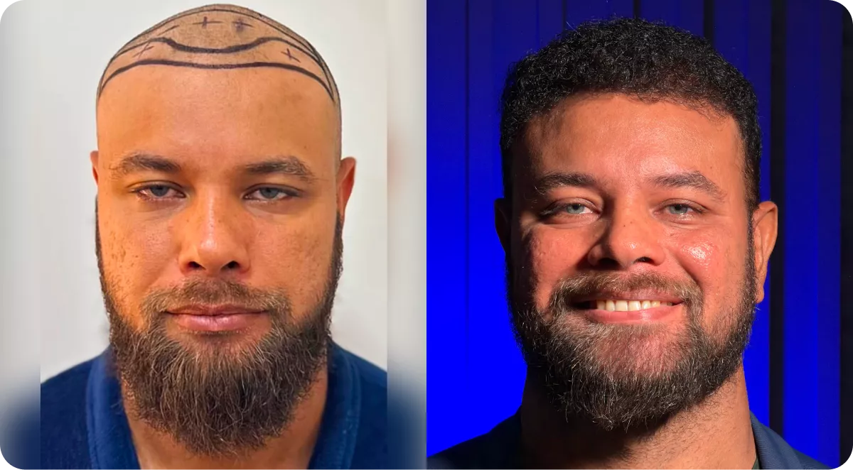 frame-1880-690918df3e9af