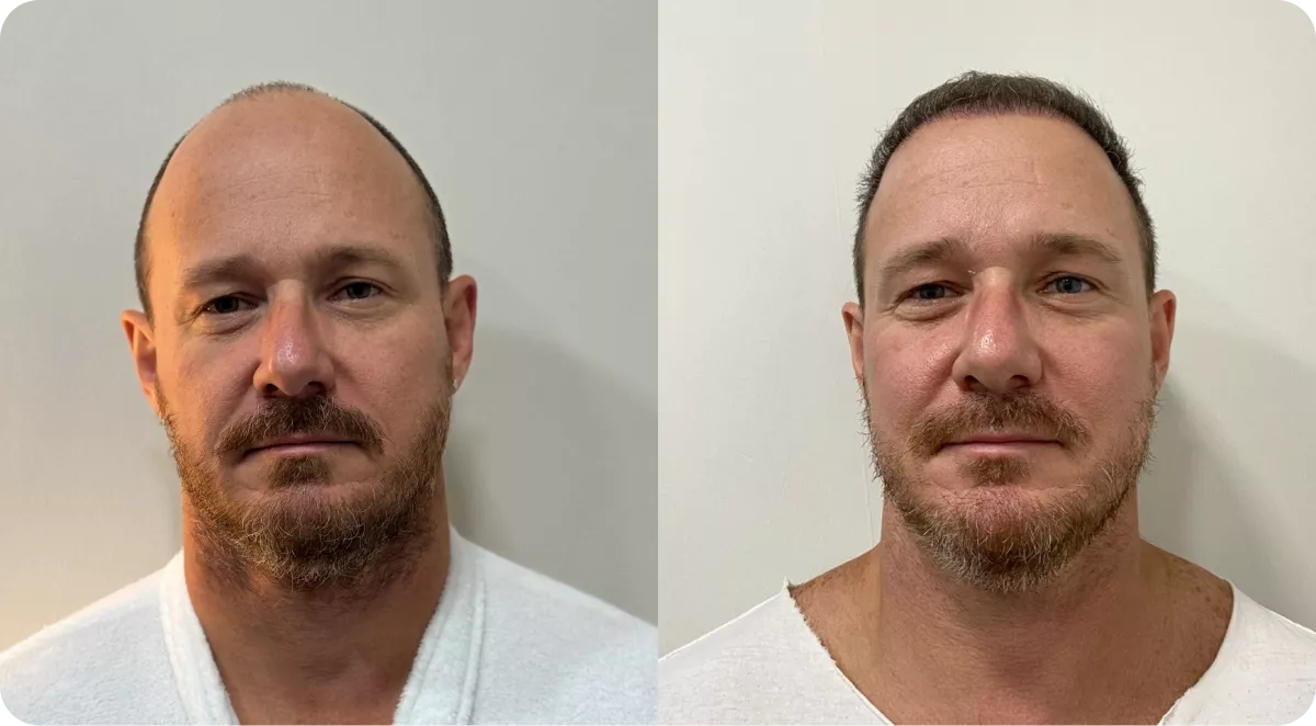 frame-1881-690918dfe4792