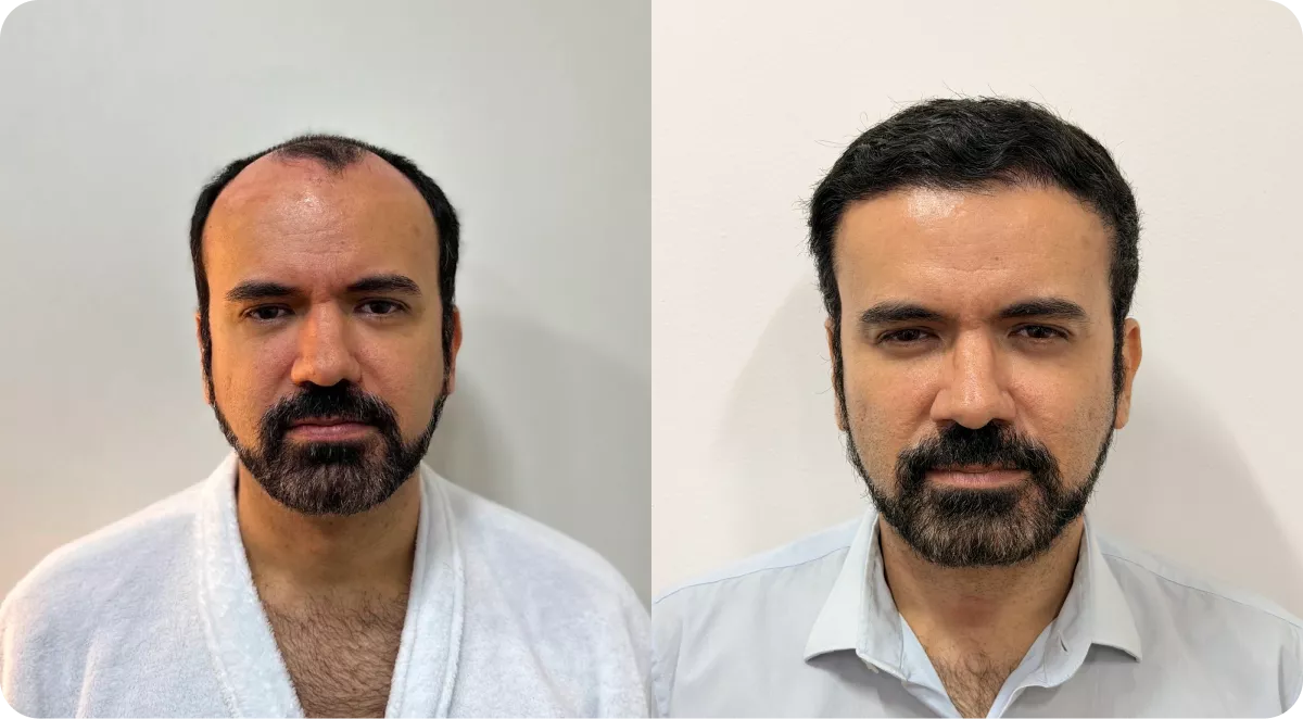 frame-1882-690918e034ec5