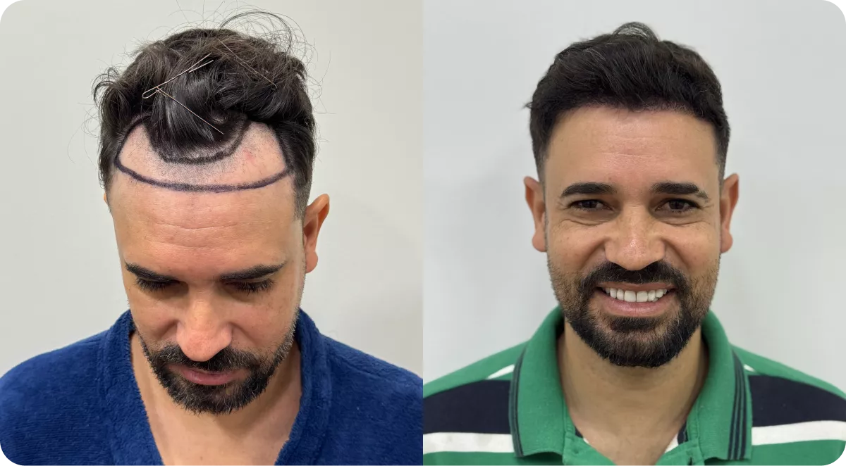 frame-1883-690918e0a532d